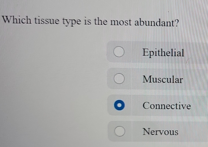 Which tissue type is the most abundant?
Epithelial
Muscular
Connective
Nervous