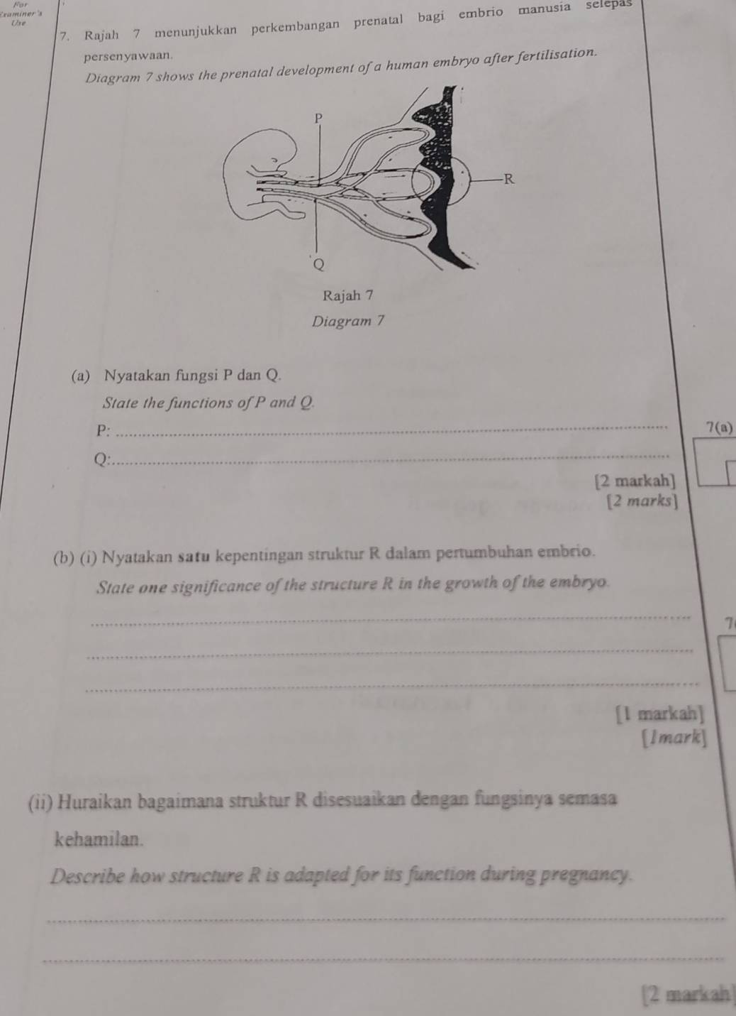 Examíner's 
7. Rajah 7 menunjukkan perkembangan prenatal bagi embrio manusia selepas 
Use 
persenyawaan. 
Diagram 7 showshe prenatal development of a human embryo after fertilisation. 
Diagram 7 
(a) Nyatakan fungsi P dan Q. 
State the functions of P and Q. 
P: 
_ 
7( a)
Q : 
_ 
[2 markah] 
[2 marks] 
(b) (i) Nyatakan satu kepentingan struktur R dalam pertumbuhan embrio. 
State one significance of the structure R in the growth of the embryo. 
_ 
7 
_ 
_ 
[l markah] 
[Imark] 
(ii) Huraikan bagaimana struktur R disesuaikan dengan fungsinya semasa 
kehamilan. 
Describe how structure R is adapted for its function during pregnancy. 
_ 
_ 
[2 markah]