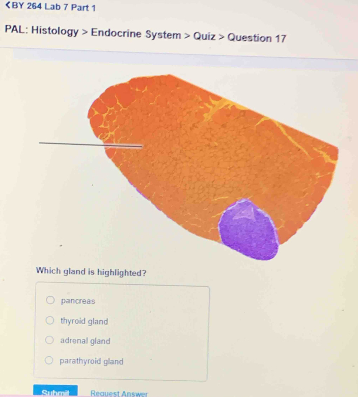 くBY 264 Lab 7 Part 1
PAL: Histology > Endocrine System > Quiz > Question 17
Which gland is highlighted?
pancreas
thyroid gland
adrenal gland
parathyroid gland
Submit Reauest Answer