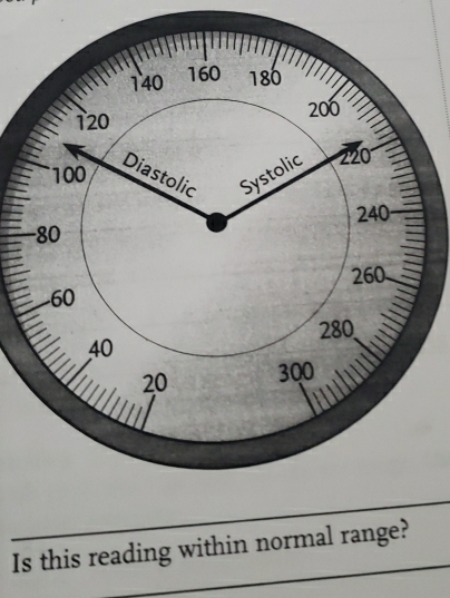 Is this reading within normal range?