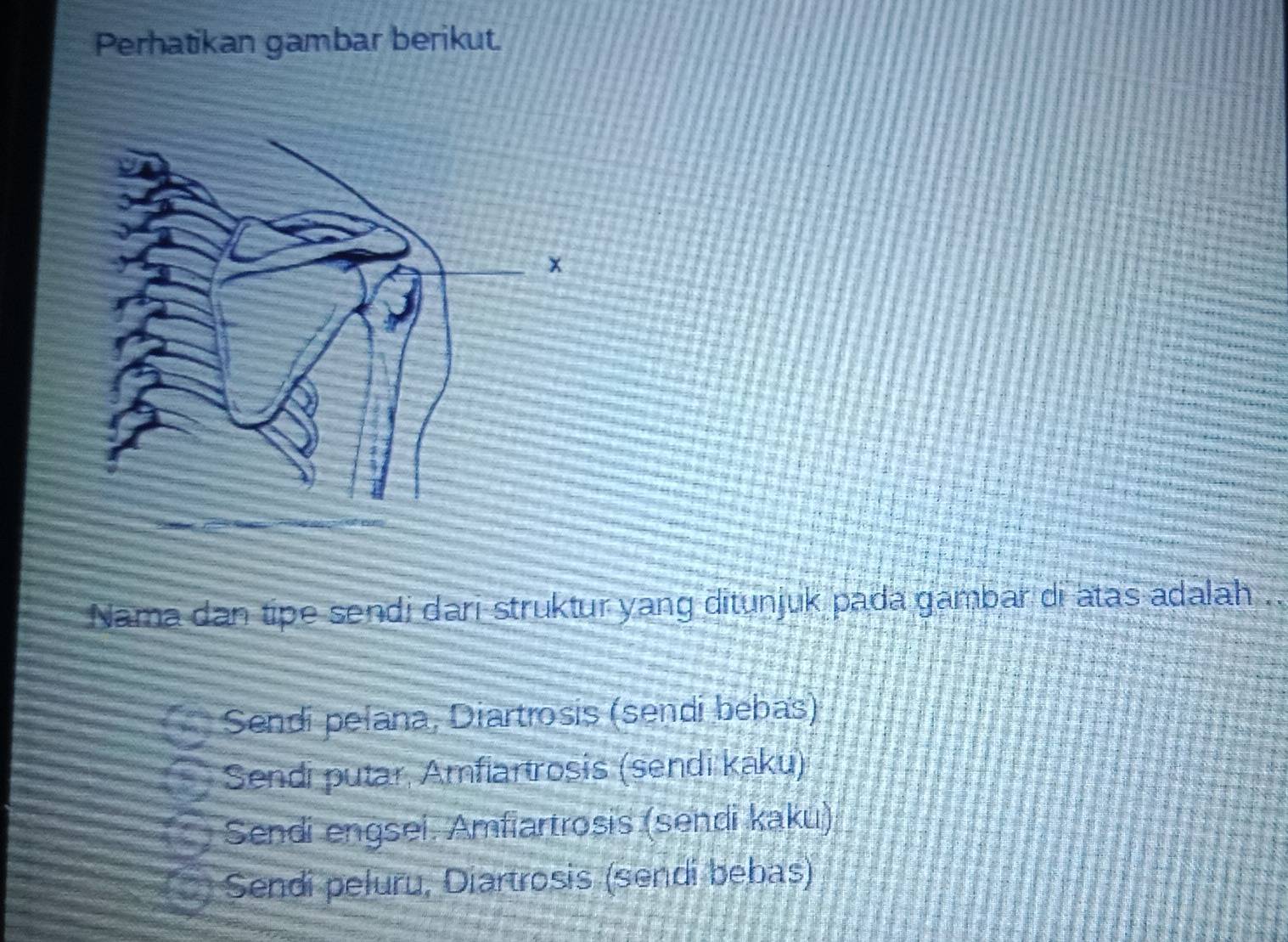 Telah dijawab:Perhatikan gambar berikut. Nama dan tipe sendi dari ...