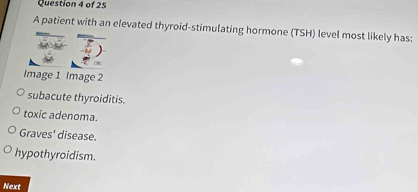 A patient with an elevated thyroid-stimulating hormone (TSH) level most likely has:
Image 1 Image 2
subacute thyroiditis.
toxic adenoma.
Graves' disease.
hypothyroidism.
Next