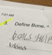 7:01 AM 
3. Define Bone. * 
_ 
_