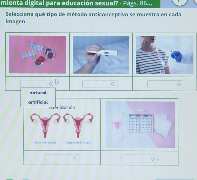 mienta digital para educación sexual? · Págs. 86...
Selecciona qué tipo de método anticonceptivo se muestra en cada
imagen.
natural
artificial
Esterilización
Antes de la cirugía Después de la cirugía