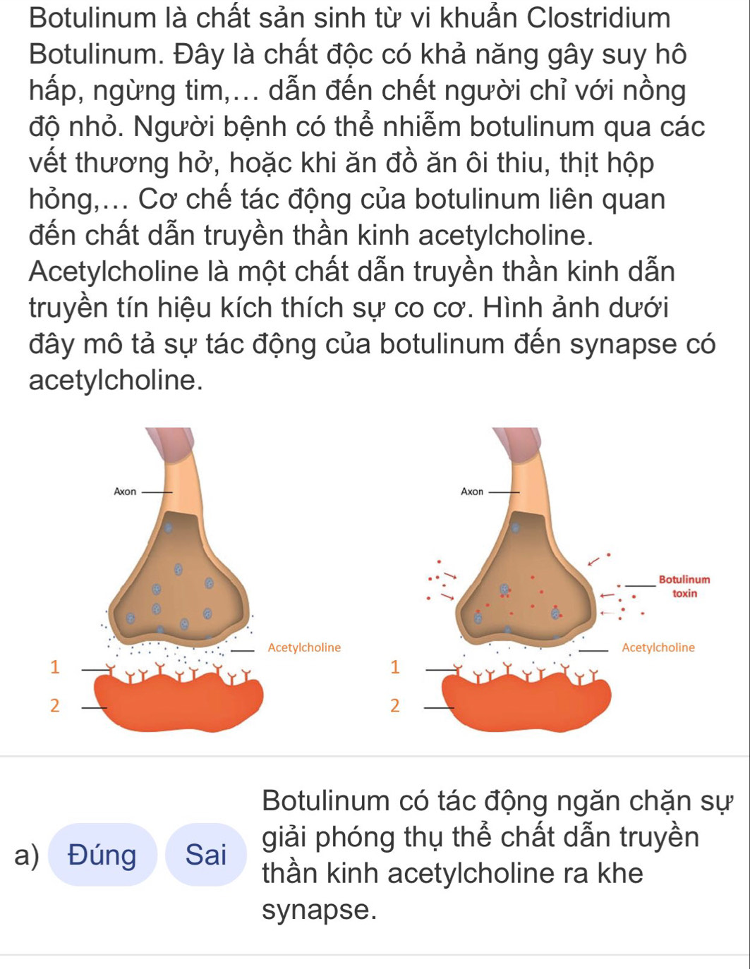 Botulinum là chất sản sinh từ vi khuẩn Clostridium 
Botulinum. Đây là chất độc có khả năng gây suy hô 
hấp, ngừng tim,... dẫn đến chết người chỉ với nồng 
độ nhỏ. Người bệnh có thể nhiễm botulinum qua các 
vết thương hở, hoặc khi ăn đồ ăn ôi thiu, thịt hộp 
hỏng,... Cơ chế tác động của botulinum liên quan 
đến chất dẫn truyền thần kinh acetylcholine. 
Acetylcholine là một chất dẫn truyền thần kinh dẫn 
truyền tín hiệu kích thích sự co cơ. Hình ảnh dưới 
đây mô tả sự tác động của botulinum đến synapse có 
acetylcholine. 

Botulinum có tác động ngăn chặn sự 
a) Đúng Sai giải phóng thụ thể chất dẫn truyền 
thần kinh acetylcholine ra khe 
synapse.