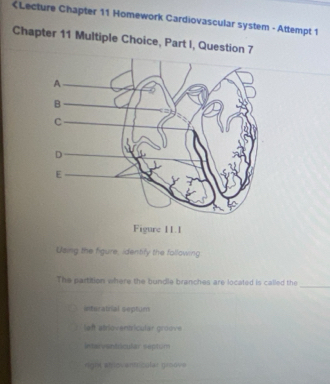 interatrial septum
left atrioventricular groove
intervonticular septum
dgnt abloventricalar groove