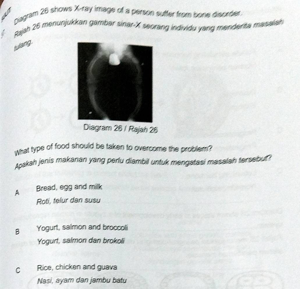 Diagram 26 shows X -ray image of a person suffer from bone disorder.
Rajah 26 menunjukkan gambar sinar- X seorang individu yang menderta masalah
fullang.
Diagram 26 / Rajah 26
What type of food should be taken to overcome the problem?
Apakah jenis makanan yang perlu diambil untuk mengatasi masalah tersebut?
A Bread, egg and milk
Roti, telur dan susu
B Yogurt, salmon and broccoli
Yogurt, salmon dan brokoli
C Rice, chicken and guava
Nasi, ayam dan jambu batu