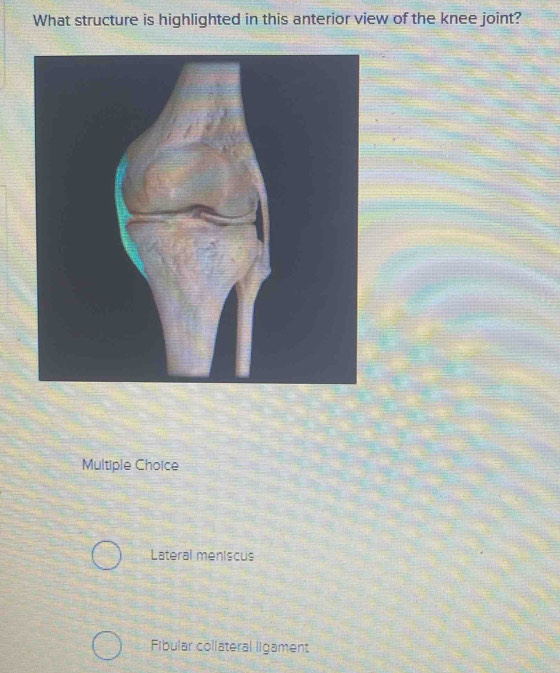 Solved: What structure is highlighted in this anterior view of the knee ...