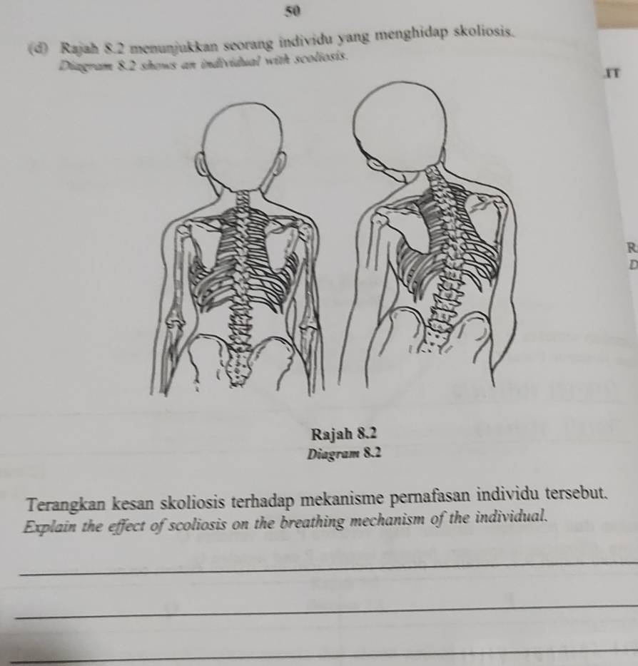 50 
(d) Rajah 8.2 menunjukkan seorang individu yang menghidap skoliosis. 
Diagram 8.2 shews an individual with scoliosis. 
.IT 
R 
D 
Rajah 8.2 
Diagram 8.2 
Terangkan kesan skoliosis terhadap mekanisme pernafasan individu tersebut. 
Explain the effect of scoliosis on the breathing mechanism of the individual. 
_ 
_ 
_