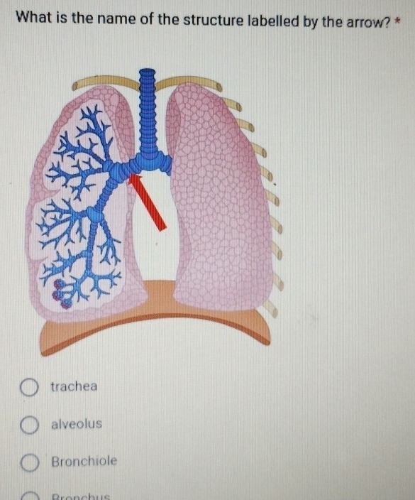 What is the name of the structure labelled by the arrow? *
trachea
alveolus
Bronchiole
Bronchus