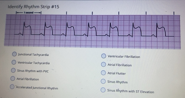 Solved: Identify Rhythm Strip #15 Junctional Tachycardia Ventricular ...