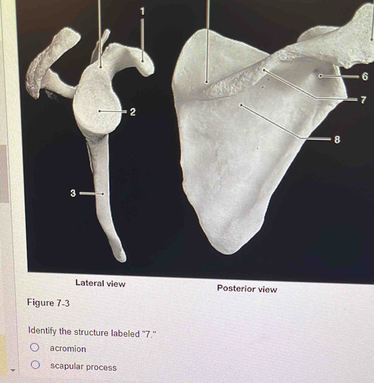 Solved: 6 7 Identify the structure labeled 