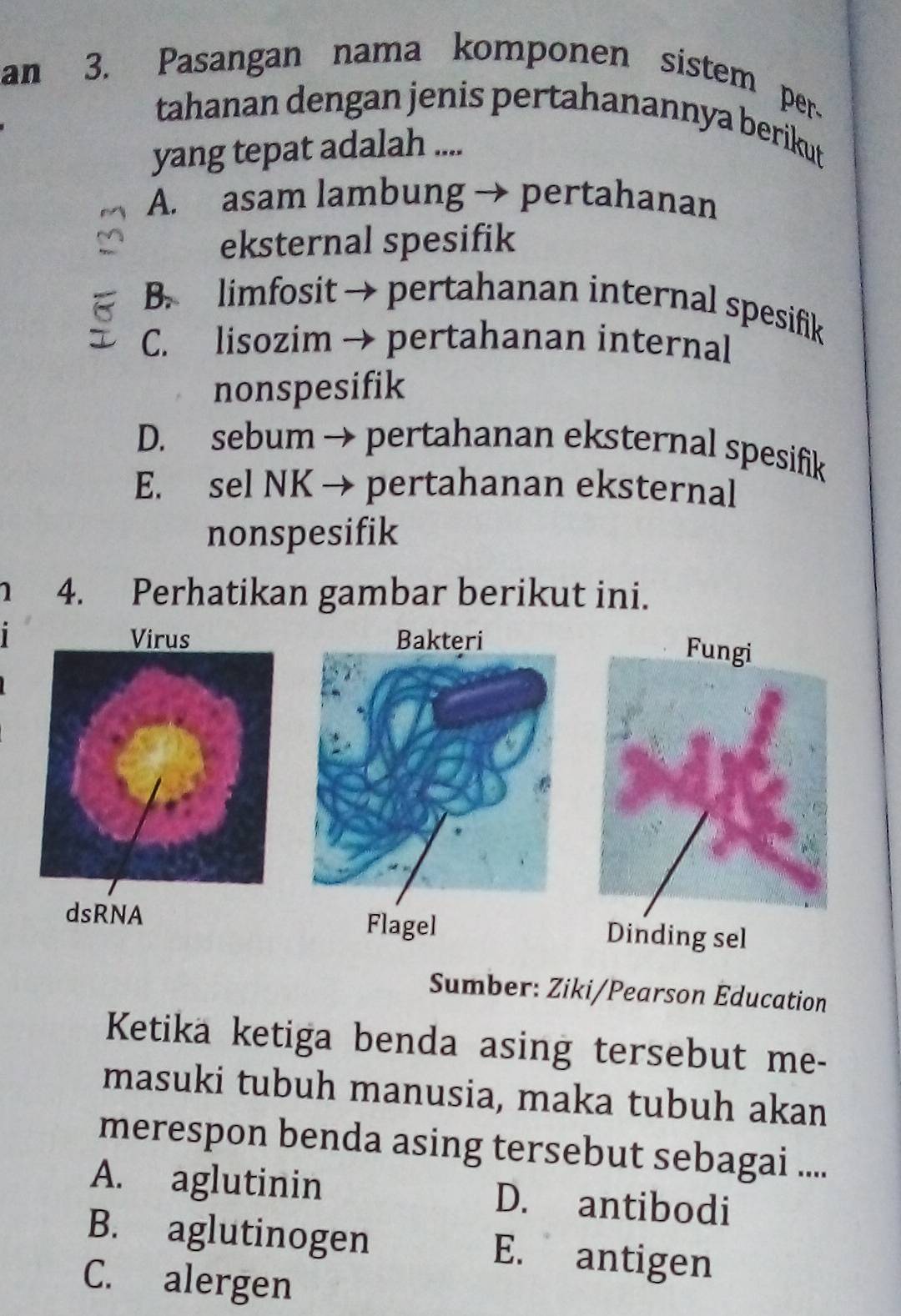 an 3. Pasangan nama komponen sistem per-
tahanan dengan jenis pertahanannya berikut
yang tepat adalah ....
A. asam lambung → pertahanan
eksternal spesifik
B. limfosit → pertahanan internal spesifik
C. lisozim → pertahanan internal
nonspesifik
D. sebum → pertahanan eksternal spesifik
E. sel NK → pertahanan eksternal
nonspesifik
4. Perhatikan gambar berikut ini.
Virus Bakteri
dsRNA Flagel Dinding sel
Sumber: Ziki/Pearson Éducation
Ketika ketiga benda asing tersebut me-
masuki tubuh manusia, maka tubuh akan
merespon benda asing tersebut sebagai ....
A. aglutinin D. antibodi
B. aglutinogen E. antigen
C. alergen