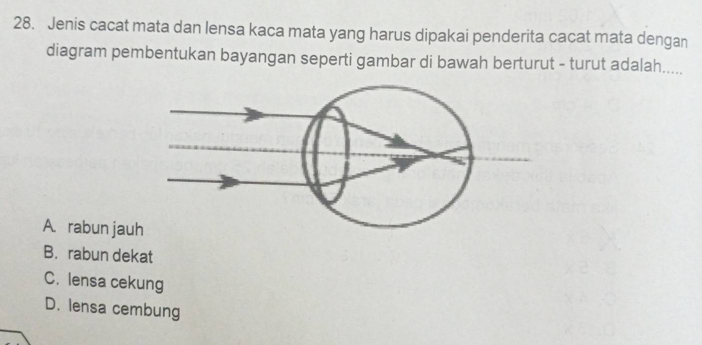 Jenis cacat mata dan lensa kaca mata yang harus dipakai penderita cacat mata dengan
diagram pembentukan bayangan seperti gambar di bawah berturut - turut adalah.....
A. rabun jau
B. rabun dekat
C. lensa cekung
D. lensa cembung