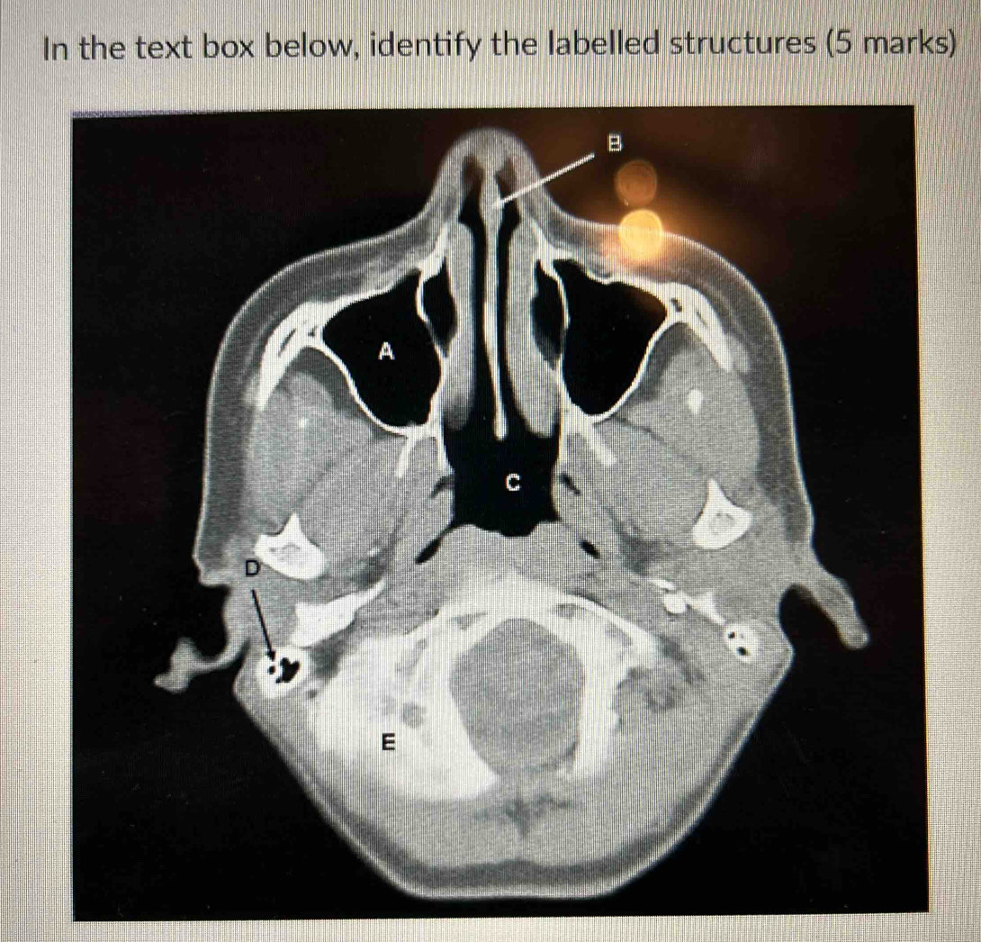 In the text box below, identify the labelled structures (5 marks)