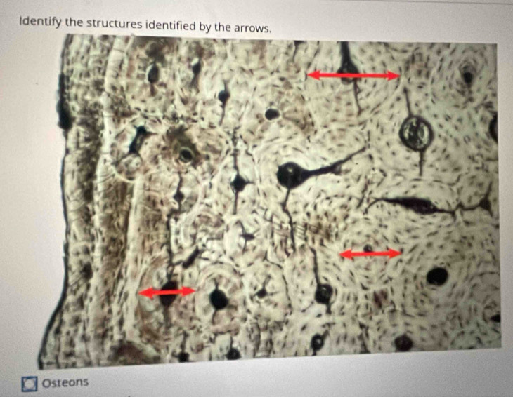 Identify the structures identif 
Osteons