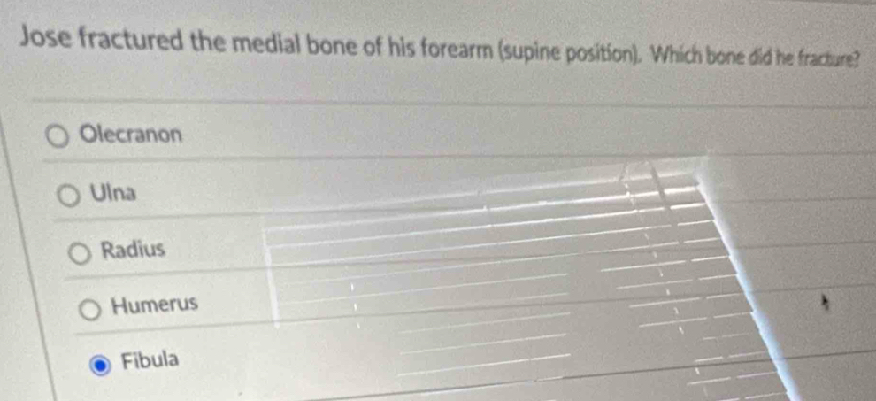 Jose fractured the medial bone of his forearm (supine position). Which bone did he fracture?
Olecranon
Ulna
Radius
Humerus
Fibula