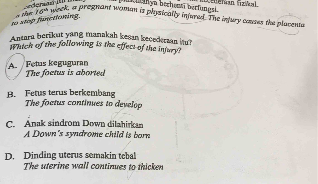 deraan fizikal.
lußenanya berhenti berfungsi.
a the 16^(th) week, a pregnant woman is physically injured. The injury causes the placenta
to stop functioning.
Antara berikut yang manakah kesan kecederaan itu?
Which of the following is the effect of the injury?
A. Fetus keguguran
The foetus is aborted
B. Fetus terus berkembang
The foetus continues to develop
C. Anak sindrom Down dilahirkan
A Down’s syndrome child is born
D. Dinding uterus semakin tebal
The uterine wall continues to thicken