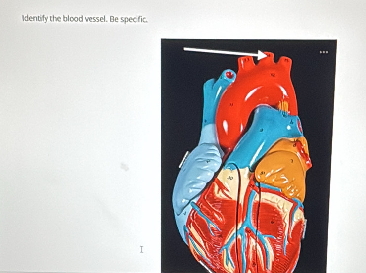 Identify the blood vessel. Be specific.