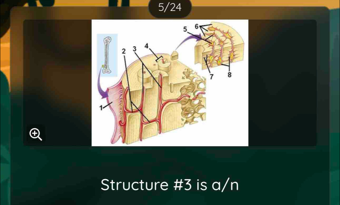 5/24
Structure # 3 is a/n