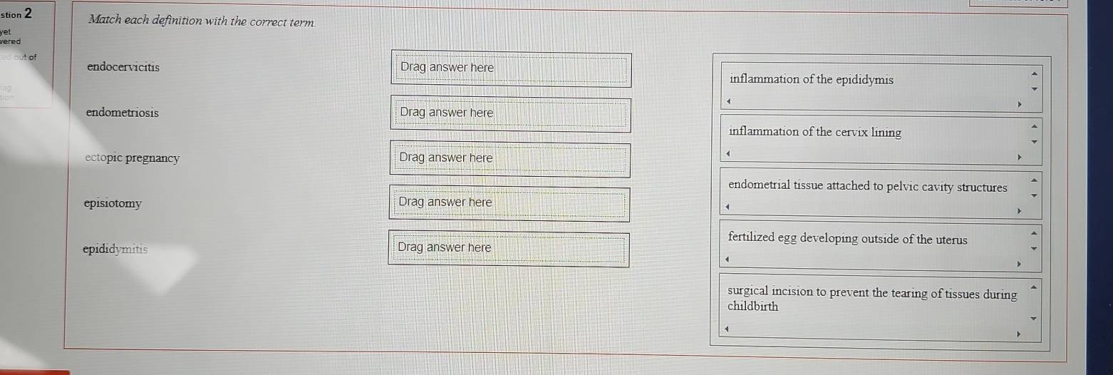 stion 2 Match each definition with the correct term
Yer
vered 
ed out of Drag answer here
endocervicitis inflammation of the epididymis
4
endometriosis Drag answer here
inflammation of the cervix lining
ectopic pregnancy Drag answer here
endometrial tissue attached to pelvic cavity structures
episiotomy Drag answer here
fertilized egg developing outside of the uterus
epididymitis Drag answer here
surgical incision to prevent the tearing of tissues during
childbirth