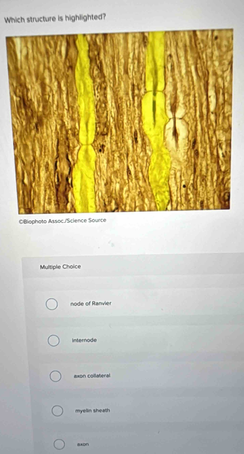 Which structure is highlighted?
©Biophoto Assoc./Science Source
Multiple Choice
node of Ranvier
internode
axon collateral
myelin sheath
axon