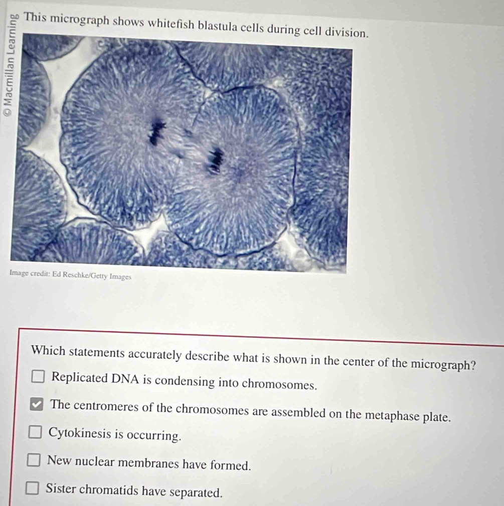 This micrograph shows whitefish blastula cells
I
Which statements accurately describe what is shown in the center of the micrograph?
Replicated DNA is condensing into chromosomes.
The centromeres of the chromosomes are assembled on the metaphase plate.
Cytokinesis is occurring.
New nuclear membranes have formed.
Sister chromatids have separated.