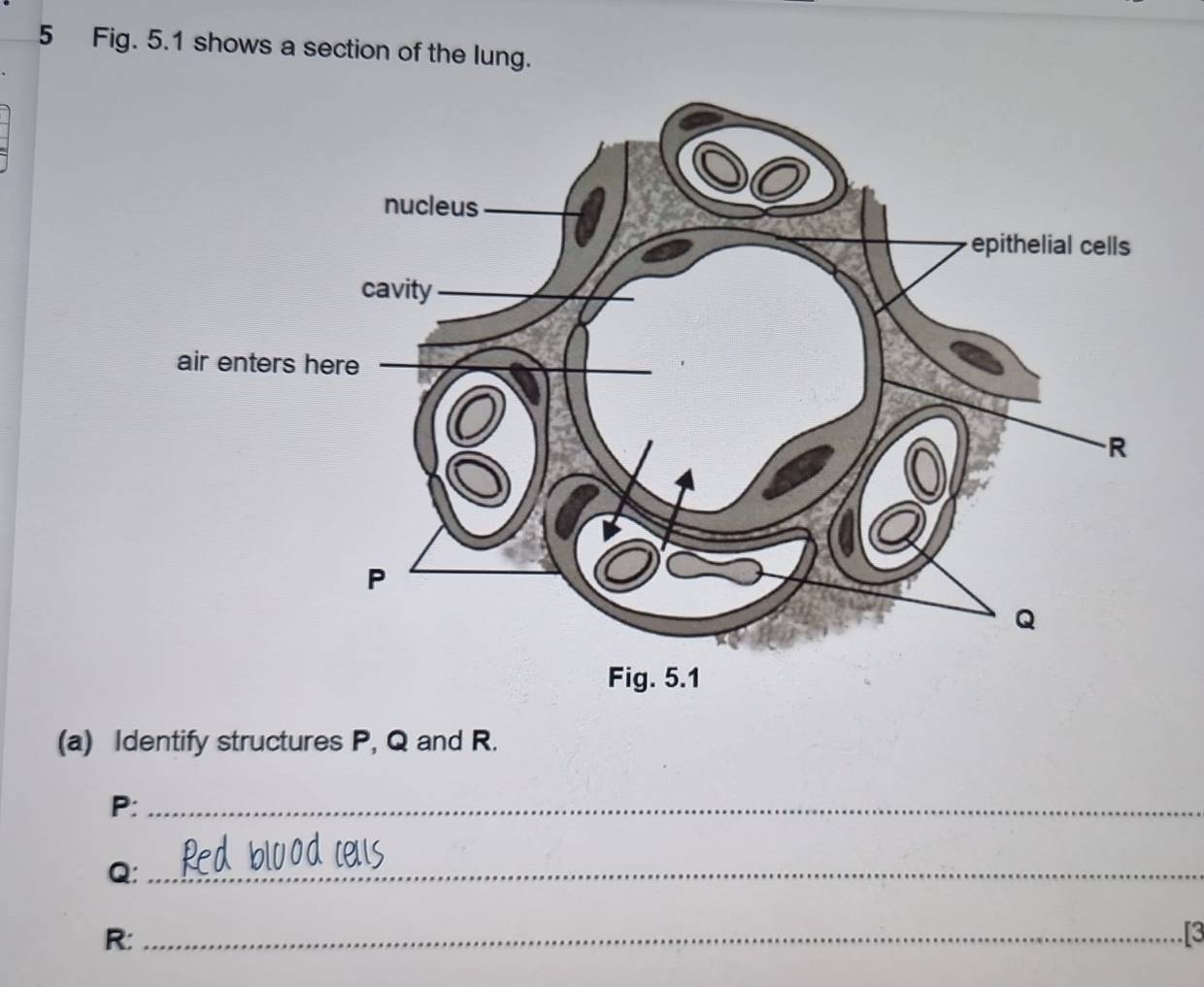 Fig. 5.1 shows a section of the lung. 
(a) Identify structures P, Q and R.
P :_
Q :_
R :_ 
3