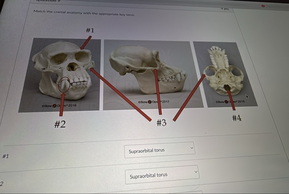 Match the cranial anatomy with the appropriate key term.
#1
Supraorbital torus
#1
Supraorbital torus
2