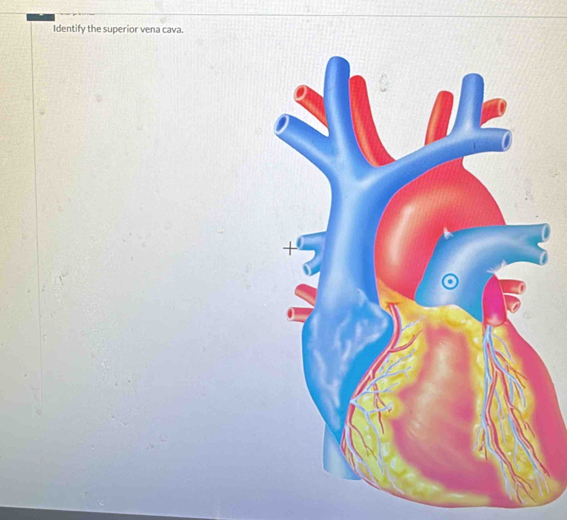 Identify the superior vena cava.