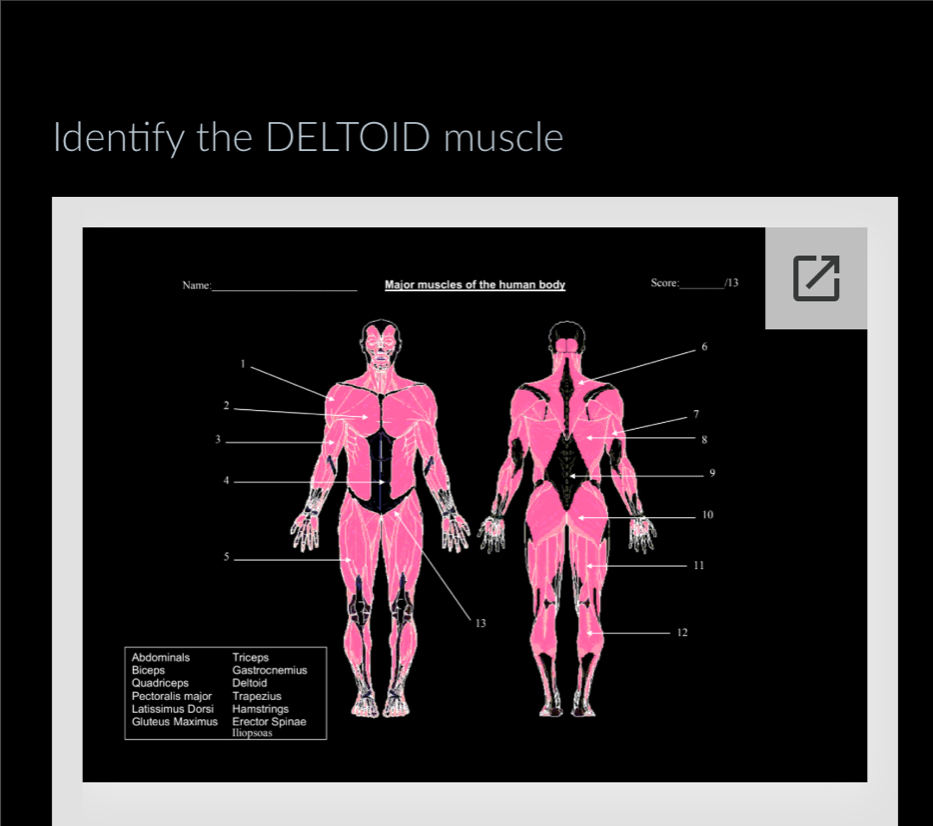 Identify the DELTOID muscle