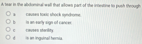 A tear in the abdominal wall that allows part of the intestine to push through
a causes toxic shock syndrome.
b is an early sign of cancer.
C causes sterility.
d is an inguinal hernia.