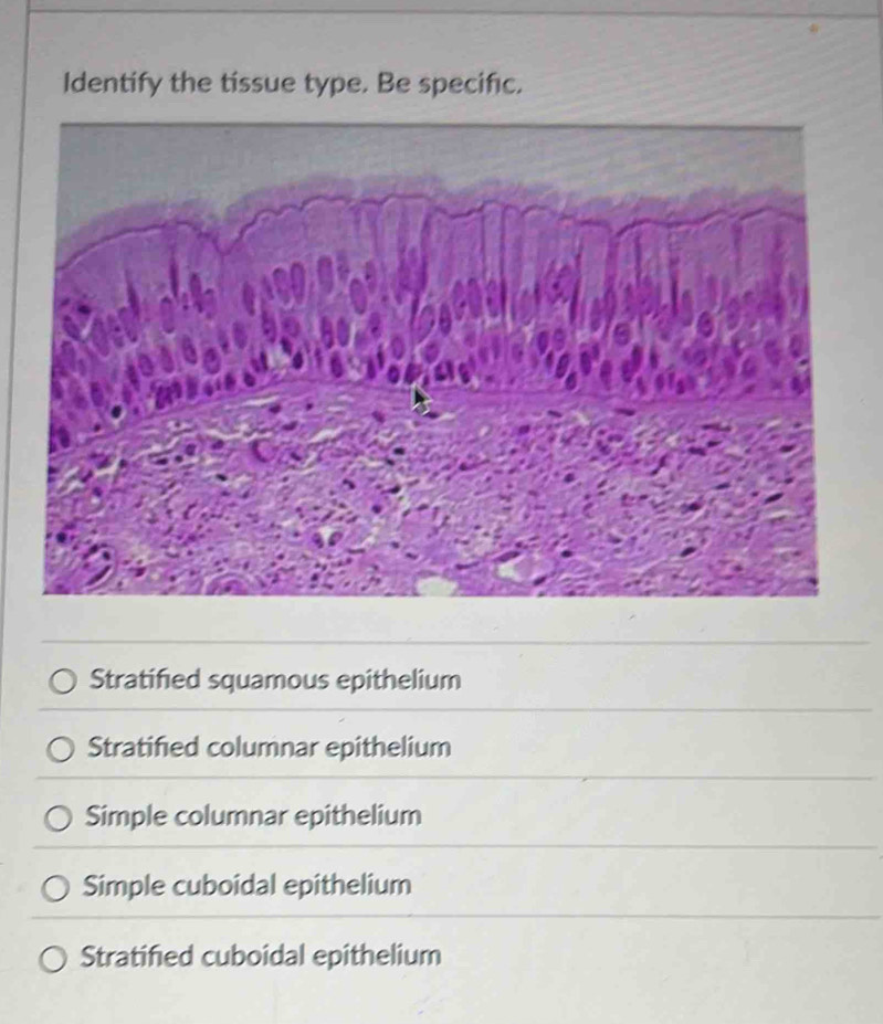 Identify the tissue type. Be specific.
Stratified squamous epithelium
Stratified columnar epithelium
Simple columnar epithelium
Simple cuboidal epithelium
Stratified cuboidal epithelium