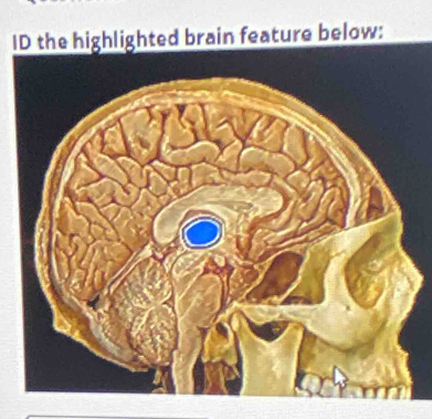 ID the highlighted brain feature below: