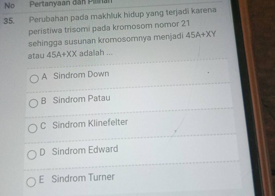 No Pertanyaan dân Pilnán 
35. Perubahan pada makhluk hidup yang terjadi karena 
peristiwa trisomi pada kromosom nomor 21 
sehingga susunan kromosomnya menjadi 45A+XY
atau 45A+XX adalah ... 
A Sindrom Down 
B Sindrom Patau 
C Sindrom Klinefelter 
D Sindrom Edward 
E Sindrom Turner