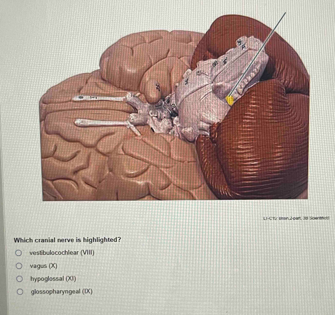 LI-C15: Brain,2-part, 3B Scientc
Which cranial nerve is highlighted?
vestibulocochlear (VIII)
vagus (X)
hypoglossal (XI)
glossopharyngeal (IX)