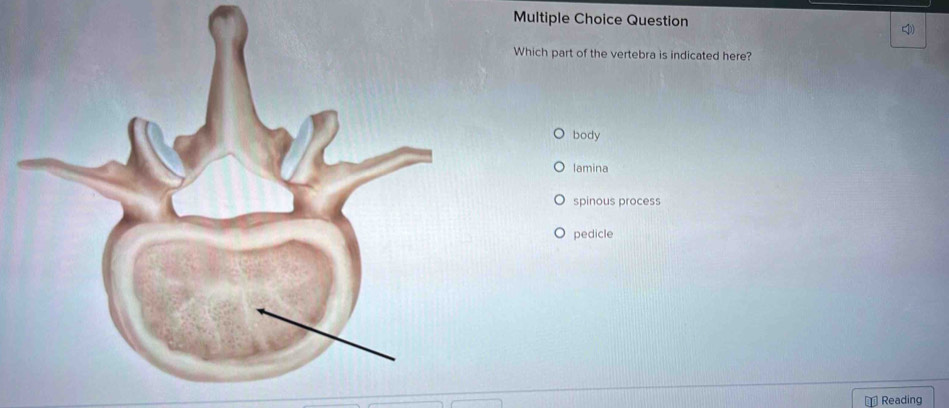 Solved: Question Which part of the vertebra is indicated here? body ...