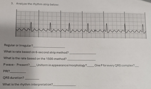 Analyze the rhythm strip below: 
Regular or Irregular?_ 
What is rate based on 6-second strip method?_ 
What is the rate based on the 1500 -method? 
_ 
Pwave - Present?_ Uniform in appearance/morphology? _One P for every QRS complex?_ 
_ 
PRI？ 
QRS duration?_ 
What is the rhythm interpretation?_