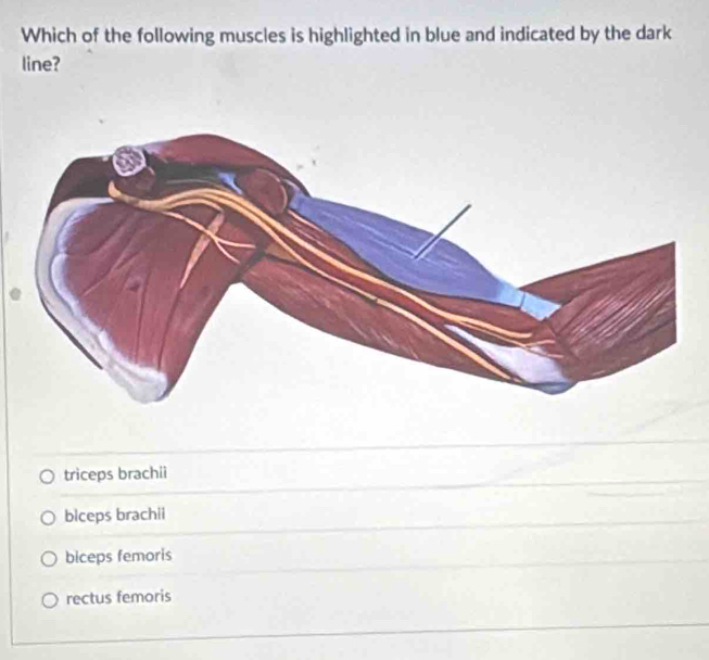 Which of the following muscles is highlighted in blue and indicated by the dark
line?
triceps brachii
biceps brachii
biceps femoris
rectus femoris