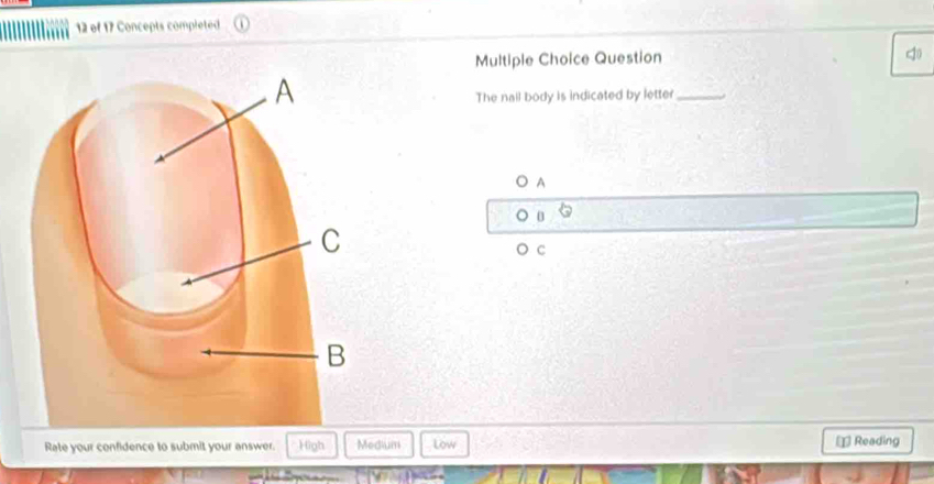 of 17 Concepts completed
Multiple Choice Question
The nail body is indicated by letter_
A
C
Rate your confidence to submit your answer. High Medium Low = Reading