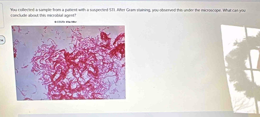 You collected a sample from a patient with a suspected STI. After Gram staining, you observed this under the microscope. What can you 
conclude about this microbial agent? 
CDC/Dr. Mike Miller. 
14