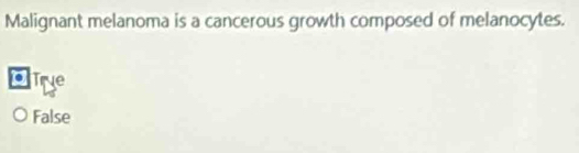 Malignant melanoma is a cancerous growth composed of melanocytes.
Tre
False