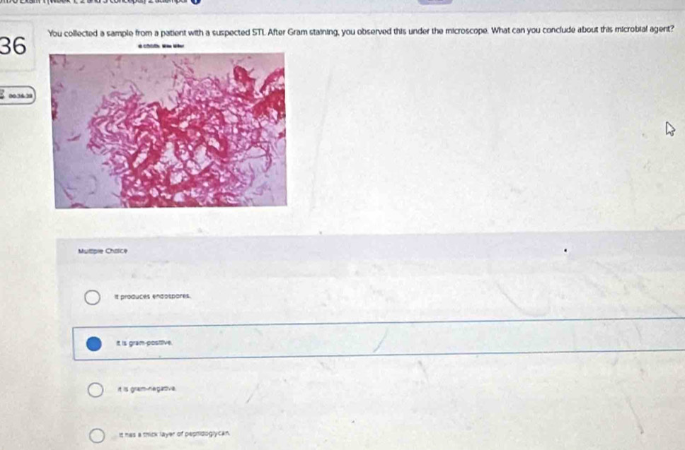 You collected a sample from a patient with a suspected STL After Gram staining, you observed this under the microscope. What can you conclude about this microbial agent?
00:36-29
Multpie Chaice
It produces endospores.
It is gram positive.
it is gram-negative.
It has a thick layer of peptidoglycan.