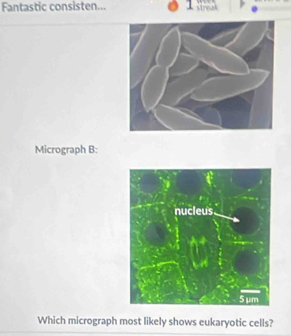 Fantastic consisten... 
Micrograph B: 
Which micrograph most likely shows eukaryotic cells?