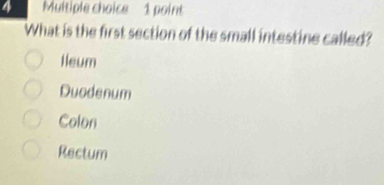 What is the first section of the small intestine called?
Ileum
Duodenum
Colon
Rectum