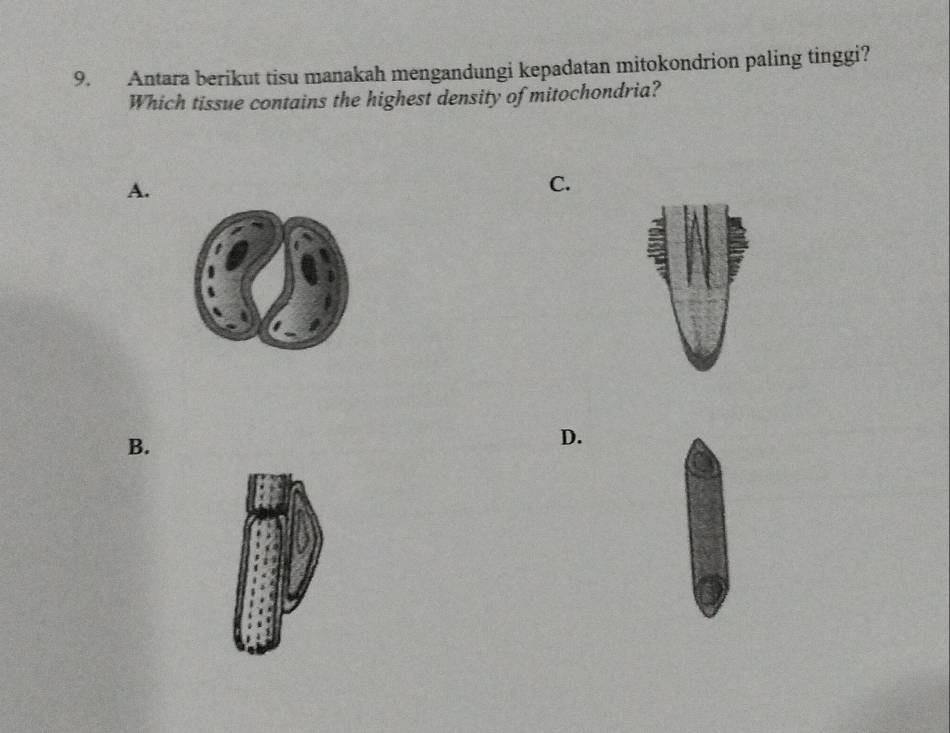 Antara berikut tisu manakah mengandungi kepadatan mitokondrion paling tinggi?
Which tissue contains the highest density of mitochondria?
A.
C.
B.
D.