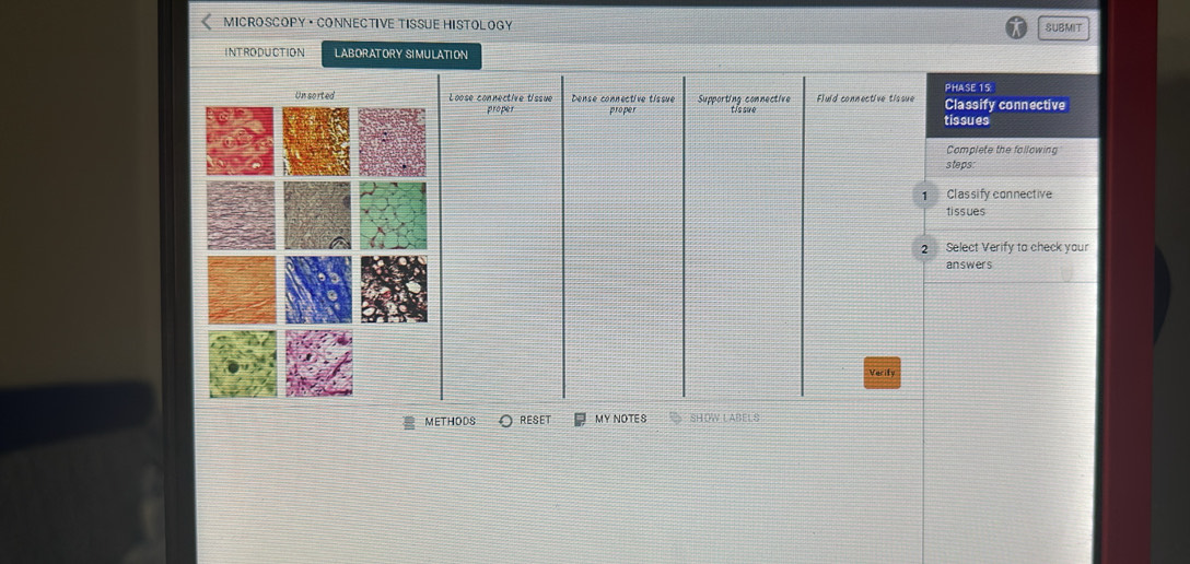 MICROSCOPY· CONNECTIVE TISSUE HISTOLOGY SUBMIT 
INTRODUCTION LABORATORY SIMULATION 
PHASE 15: 
Loose connective tissue Dense connective tissue proper Supporting connective Fluid connective tissue Classify connective 
proper t /s sue tissues 
Complete the fallowing 
steps: 
1 Classify connective 
tissues 
2 Select Verify to check your 
answers 
METHODS RESET MY NOTES SHOW LABELS