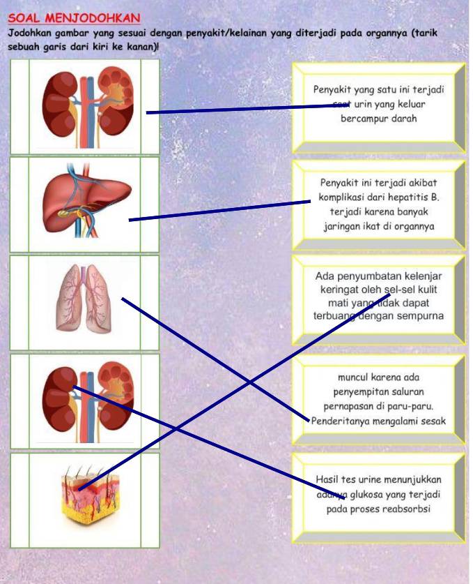 SOAL MENJODOHKAN 
Jodohkan gambar yang sesuai dengan penyakit/kelainan yang diterjadi pada organnya (tarik 
sebu