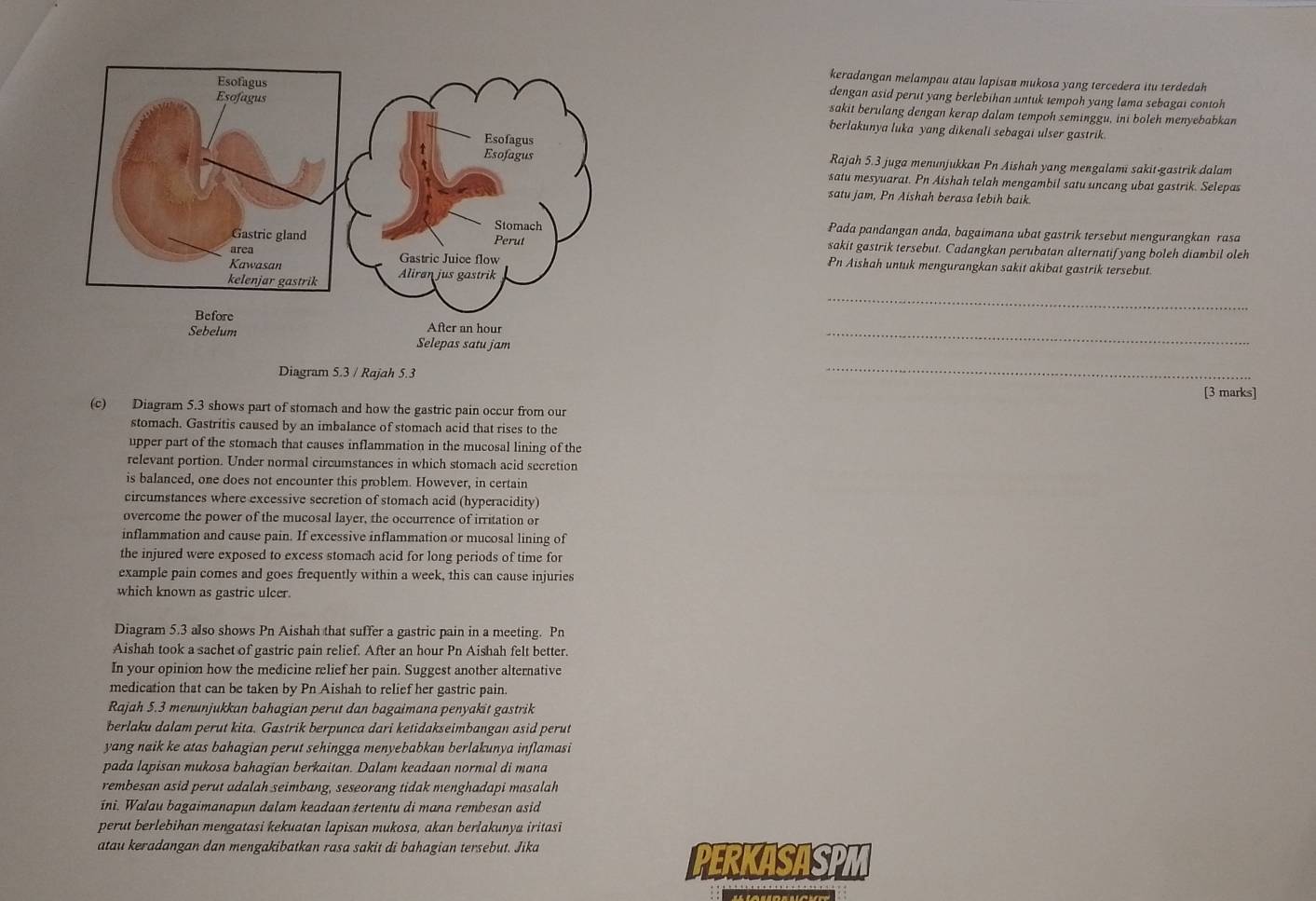 keradangan melampau atau lapisan mukosa yang tercedera itu terdedah
dengan asid perut yang berlebihan untuk tempoh yang lama sebagai contoh
sakit berulang dengan kerap dalam tempoh seminggu, ini boleh menyebabkan
berlakunya luka yang dikenali sebagai ulser gastrik
Rajah 5.3 juga menunjukkan Pn Aishah yang mengalami sakit-gastrik dalam
satu mesyuarat. Pn Aishah telah mengambil satu uncang ubat gastrik. Selepas
satu jam, Pn Aishah berasa lebih baik
Pada pandangan anda, bagaimana ubat gastrik tersebut mengurangkan rasa
sakit gastrik tersebut. Cadangkan perubatan alternatif yang boleh diambil oleh
Pn Aishah untuk mengurangkan sakit akibat gastrik tersebut.
_
_
Diagram 5.3 / Rajah 5.3
_
[3 marks]
(c) Diagram 5.3 shows part of stomach and how the gastric pain occur from our
stomach. Gastritis caused by an imbalance of stomach acid that rises to the
upper part of the stomach that causes inflammation in the mucosal lining of the
relevant portion. Under normal circumstances in which stomach acid secretion
is balanced, one does not encounter this problem. However, in certain
circumstances where excessive secretion of stomach acid (hyperacidity)
overcome the power of the mucosal layer, the occurrence of irritation or
inflammation and cause pain. If excessive inflammation or mucosal lining of
the injured were exposed to excess stomach acid for long periods of time for
example pain comes and goes frequently within a week, this can cause injuries
which known as gastric ulcer.
Diagram 5.3 also shows Pn Aishah that suffer a gastric pain in a meeting. Pn
Aishah took a sachet of gastric pain relief. After an hour Pn Aishah felt better.
In your opinion how the medicine relief her pain. Suggest another alternative
medication that can be taken by Pn Aishah to relief her gastric pain.
Rajah 5.3 menunjukkan bahagian perut dan bagaimana penyakit gastrik
berlaku dalam perut kita. Gastrik berpunca dari ketidakseimbangan asid perut
yang naik ke atas bahagian perut sehingga menyebabkan berlakunya inflamasi
pada lapisan mukosa bahagian berkaitan. Dalam keadaan normal di mana
rembesan asid perut adalah seimbang, seseorang tidak menghadapi masalah
ini. Walau bagaimanapun dalam keadaan tertentu di mana rembesan asid
perut berlebihan mengatasi kekuatan lapisan mukosa, akan berlakunya iritasi
atau keradangan dan mengakibatkan rasa sakit di bahagian tersebut. Jika
PERKASASPM