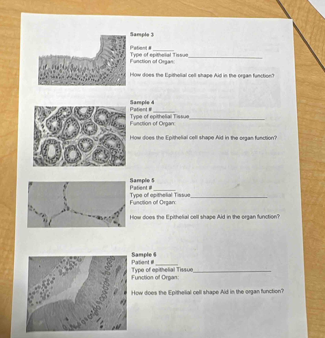 ample 3 
atient #_ 
ype of epithelial Tissue_ 
unction of Organ: 
ow does the Epithelial cell shape Aid in the organ function? 
ample 4 
Patient #_ 
Type of epithelial Tissue_ 
Function of Organ: 
ow does the Epithelial cell shape Aid in the organ function? 
ample 5 
atient #_ 
ype of epithelial Tissue_ 
unction of Organ: 
ow does the Epithelial cell shape Aid in the organ function? 
ample 6 
Patient #_ 
Type of epithelial Tissue_ 
Function of Organ: 
How does the Epithelial cell shape Aid in the organ function?